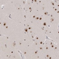 Anti-CXorf23 antibody produced in rabbit 