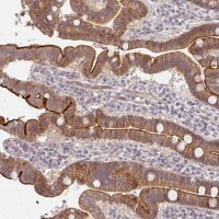 Anti-CXorf40B antibody produced in rabbit 