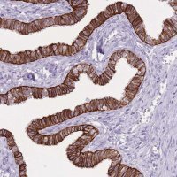 Anti-CXORF57 antibody produced in rabbit 