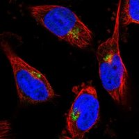 Anti-CYB5R2 antibody produced in rabbit 