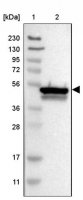 Anti-CYB5R4 antibody produced in rabbit HPA018992-100UL