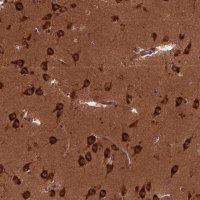 Anti-CYFIP1 antibody produced in rabbit 
