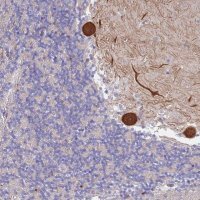 Anti-CYLD antibody produced in rabbit