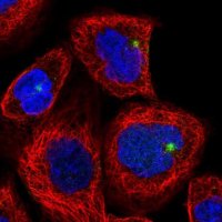 Anti-CYLD antibody produced in rabbit