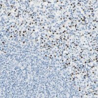 Anti-CYSLTR1 antibody produced in rabbit HPA010546-100UL