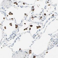 Anti-CYSLTR1 antibody produced in rabbit HPA010546-100UL
