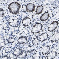 Anti-DACH1 antibody produced in rabbit 