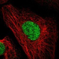 Anti-DACH1 antibody produced in rabbit 