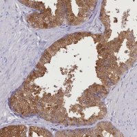 Anti-DCAF16 antibody produced in rabbit 