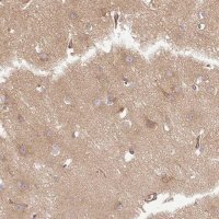 Anti-DCTN1 antibody produced in rabbit HPA034635-100UL