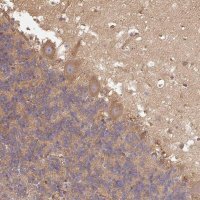 Anti-DCTN1 antibody produced in rabbit HPA034635-100UL
