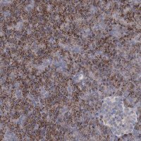 Anti-DCUN1D2 antibody produced in rabbit 