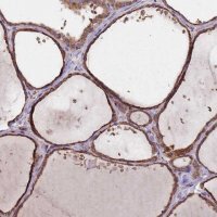 Anti-DCUN1D3 antibody produced in rabbit 