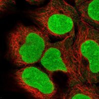 Anti-DCUN1D5 antibody produced in rabbit HPA050863-100UL