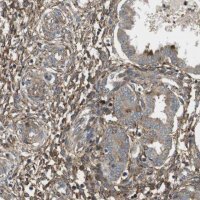 Anti-DDAH2 antibody produced in rabbit HPA012509-100UL