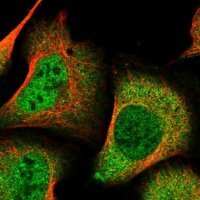 Anti-DDI2 antibody produced in rabbit 