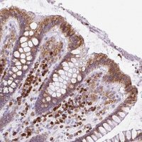 Anti-DDOST antibody produced in rabbit 