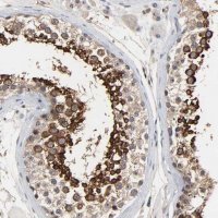 Anti-DDX10 antibody produced in rabbit