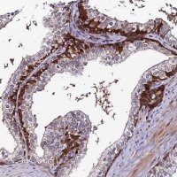 Anti-DDX19A antibody produced in rabbit 