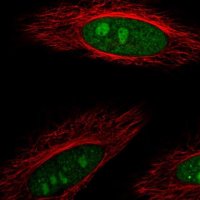 Anti-DDX23 antibody produced in rabbit HPA039037-100UL