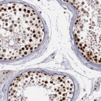 Anti-DDX24 antibody produced in rabbit 