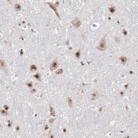 Anti-DDX24 antibody produced in rabbit 