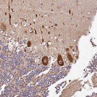 Anti-DDX27 antibody produced in rabbit