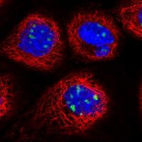 Anti-DDX27 antibody produced in rabbit
