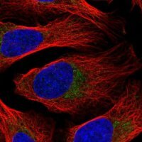 Anti-DDX28 antibody produced in rabbit 
