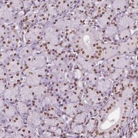Anti-DDX3X antibody produced in rabbit 