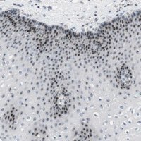 Anti-DDX47 antibody produced in rabbit HPA014855-100UL