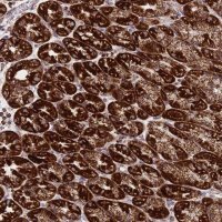 Anti-DDX49 antibody produced in rabbit 