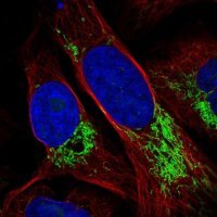 Anti-DDX49 antibody produced in rabbit 