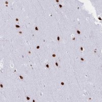 Anti-DDX52 antibody produced in rabbit 