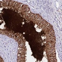 Anti-DEFB106B antibody produced in rabbit 