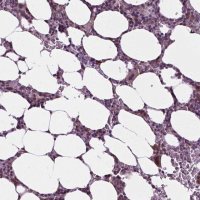 Anti-DENND4A antibody produced in rabbit 