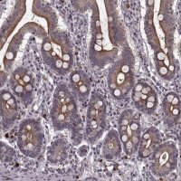 Anti-DENND4B antibody produced in rabbit 