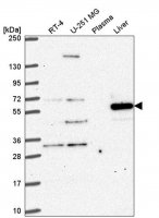 Anti-DENND6A antibody produced in rabbit 