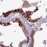 Anti-DEPDC1B antibody produced in rabbit HPA072558-100UL