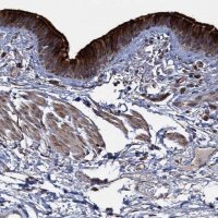 Anti-DEPDC4 antibody produced in rabbit