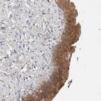 Anti-DEPTOR antibody produced in rabbit