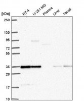 Anti-DERA antibody produced in rabbit HPA055897-100UL