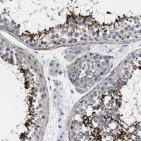 Anti-DGKE antibody produced in rabbit 