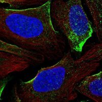 Anti-DGKG antibody produced in rabbit 