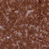 Anti-DHCR7 antibody produced in rabbit 