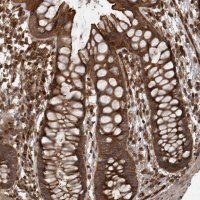 Anti-DHDDS antibody produced in rabbit