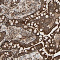 Anti-DHRS3 antibody produced in rabbit 