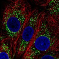 Anti-DHTKD1 antibody produced in rabbit
