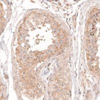 Anti-DICER1 antibody produced in rabbit