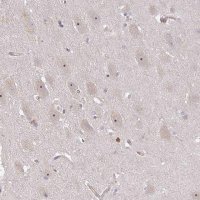 Anti-DIMT1 antibody produced in rabbit